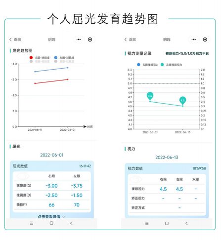 个人屈光发育趋势图